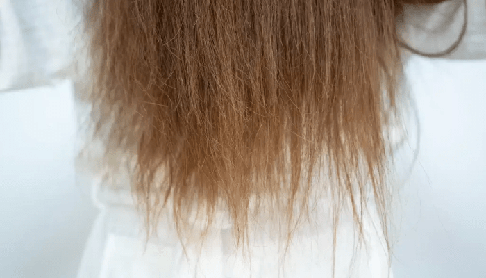 علاج تلف الشعر والبشرة للمصريين في الخليج بسبب المياه المالحة خلال الصيف 2 علاج تلف الشعر والبشرة للمصريين في الخليج بسبب المياه المالحة خلال الصيف