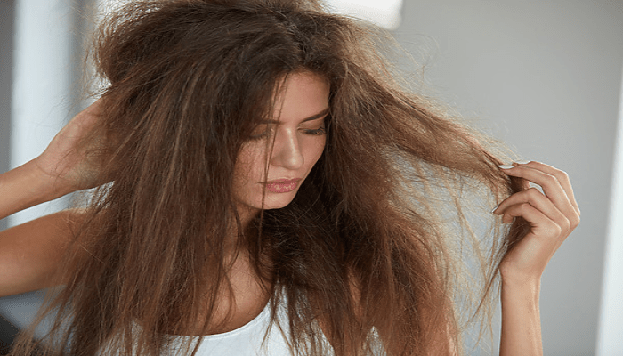 علاج تلف الشعر والبشرة للمصريين في الخليج بسبب المياه المالحة خلال الصيف 3 علاج تلف الشعر والبشرة للمصريين في الخليج بسبب المياه المالحة خلال الصيف
