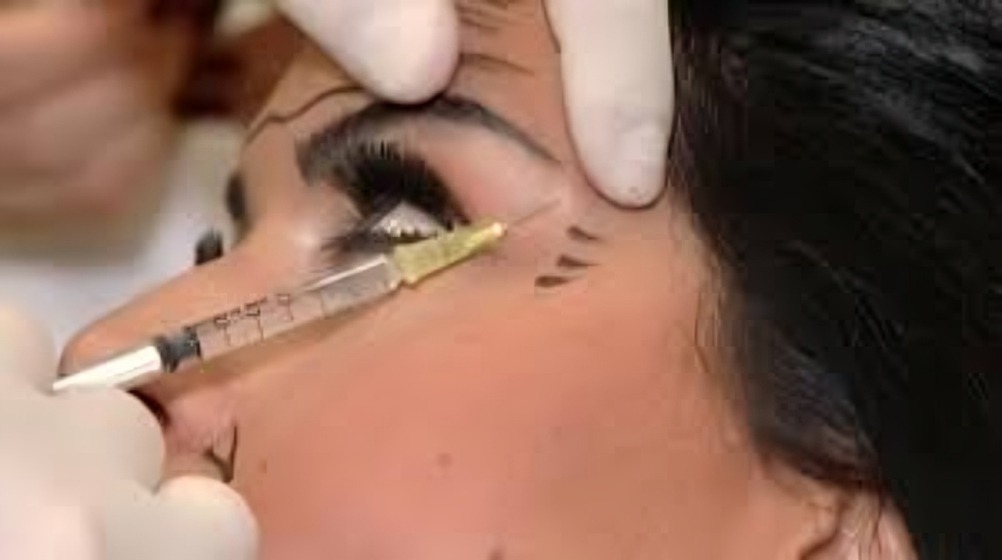 الإقبال على عمليات التجميل في الخليج.. هل أصبح الأمر طبيعيًا؟ 3 عمليات التجميل في الخليج