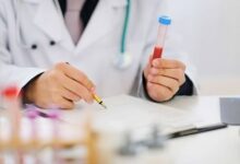 تحاليل السفر إلى الإمارات.. هل توجد أمراض تمنع إصدار التأشيرة؟ 3 تحاليل السفر للإمارات